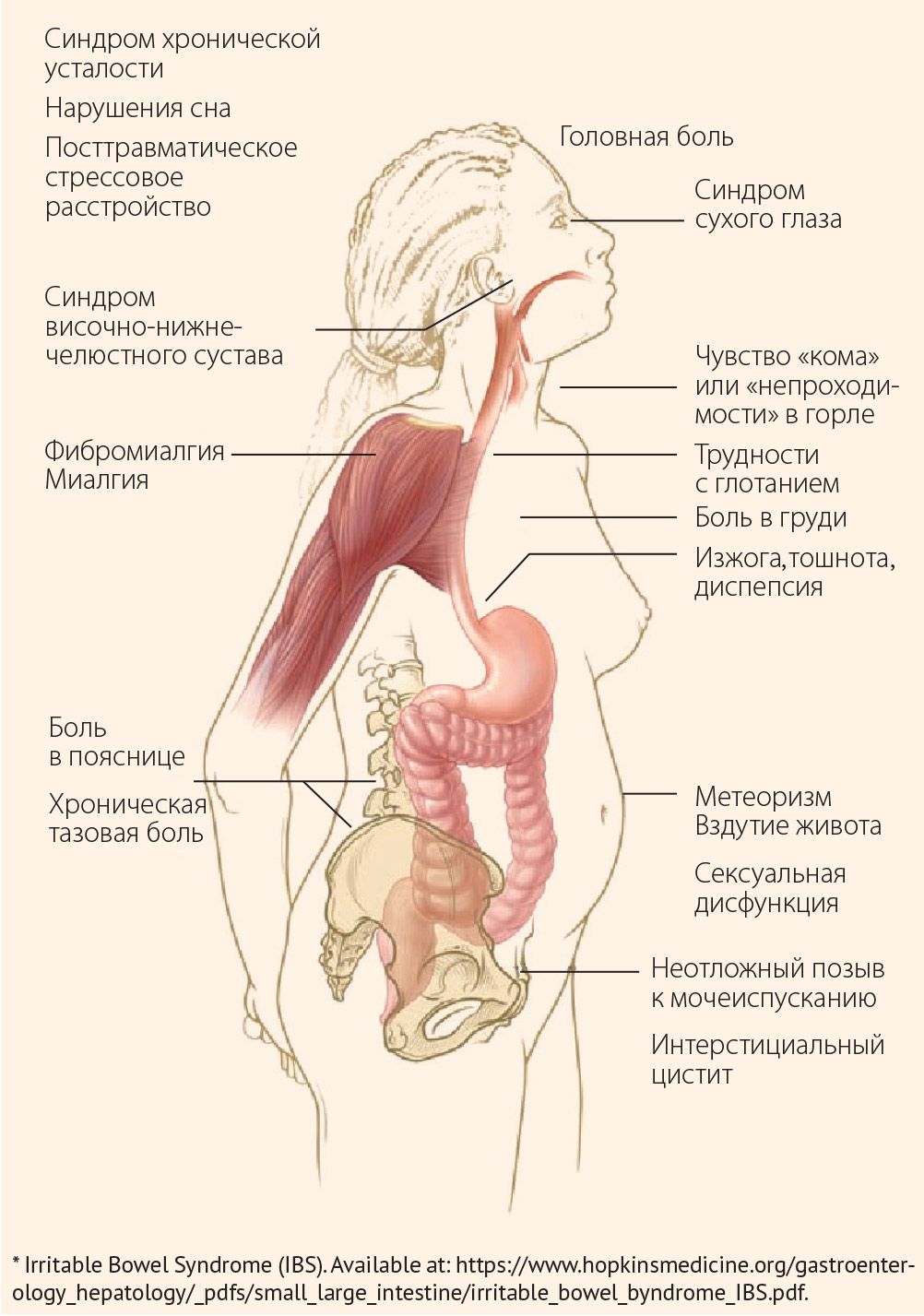 Клинические проявления СРК